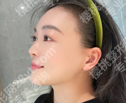 长征医院朱晓海怎么样？含热门医生信息与经典案例了解
