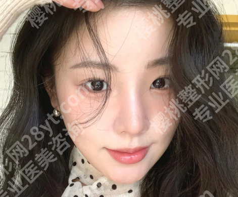 上海艺星林华芬医生怎么样？速看详细案例过程