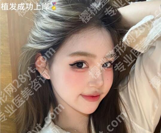 天津碧莲盛植发怎么样？医院基本信息|真人植发手术过程分享！