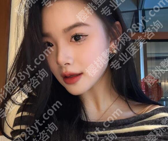 八大处整形医院玻尿酸价格贵不贵？人气医生名单出炉！