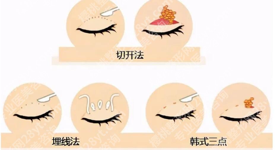 江苏淮安佳妍医院怎么样？人气医美测评、优点为你剖析！