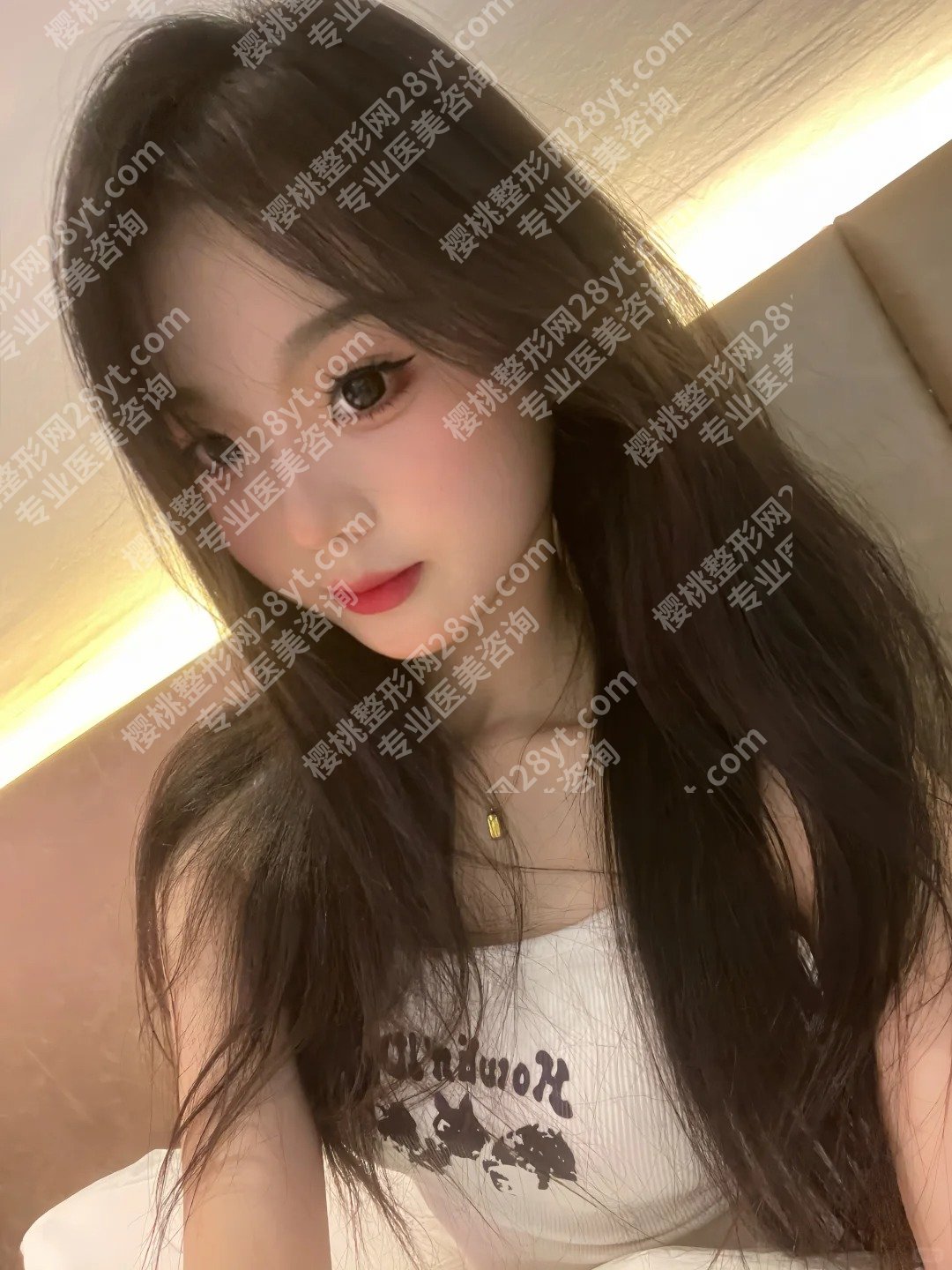 北京何照华医生做的韩系风格是什么样的？技术和审美双双在线、案例鉴赏