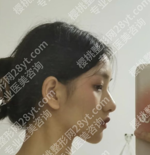 南阳面部吸脂哪里好？当地公立医院基本信息在线了解！很可靠哦！