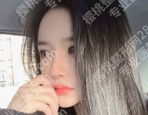 北京宋超超整容价格是多少？公布项目收费标准_查看相关案例过程