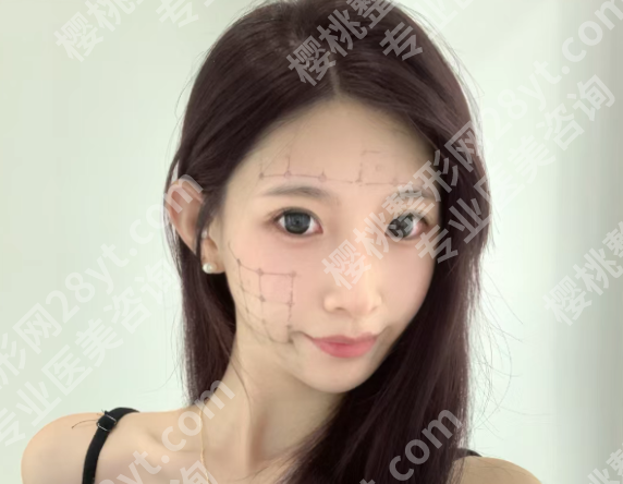 合肥艺星做热玛吉多少钱？医院相关信息一览、附价格参考！
