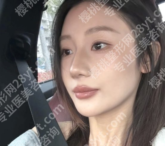 无锡二院整形科价格表一览！口碑医生简介|案例展示！
