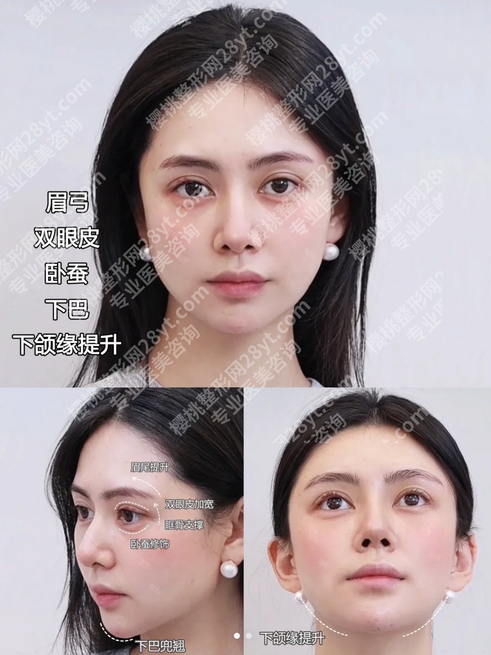 上海倪锋医生拉皮怎样？技术靠谱吗？网友亲身经历分享！