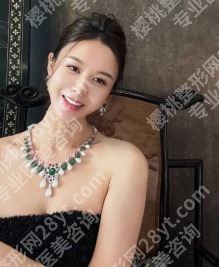 张晴医生简历公布！基本信息及真实网友体验感一览