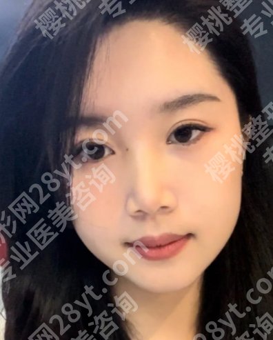 杭州时光整形医院是正规医院吗?医院介绍、真实案例、顾客点评展示