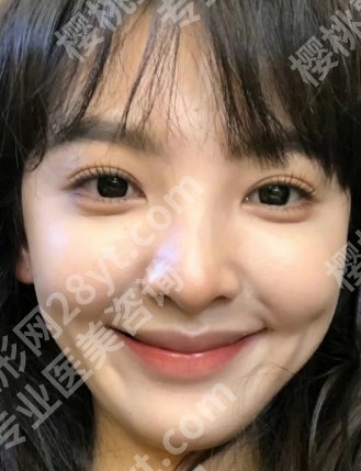 杭州刘尊敏做双眼皮手术好吗?医生技术点评、口碑点评、价格参考公开