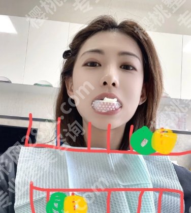 上海十院种植牙多少钱一个？院内设备及环境优势分析！