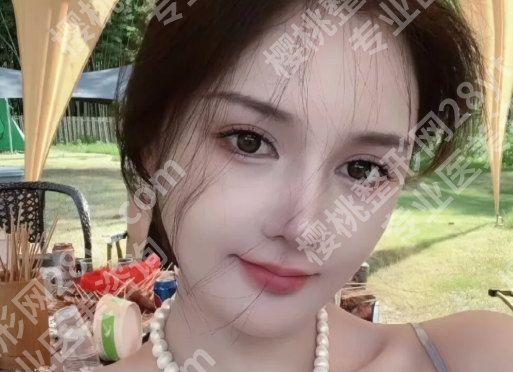 北京高亚东大拉皮手术怎么样？含医生案例过程详情