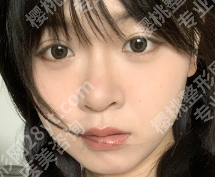 上海周兆平好约吗？揭晓面诊流程_附案例过程