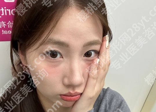 阜阳市人民医院整形美容科价格表更新一览！院内实力医生简介！客户术后案例分享！