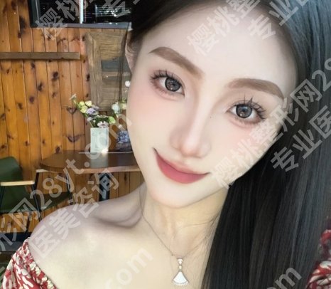 周敏茹医生脸上微调怎么样？有后遗症吗？坐诊医院介绍！