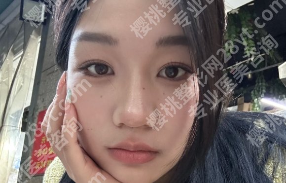 深圳市人民医院整形价格表一览！内附医院特色项目！客户口碑分享！