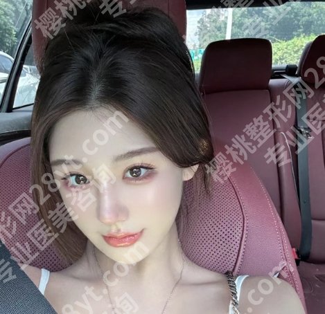 北京张曼技术咋样？口碑好不好？个人资料及价格表出炉！