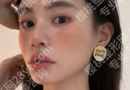 北大医院整形外科点痣价格表更新一览！院内实力医生推荐及客户口碑分享！