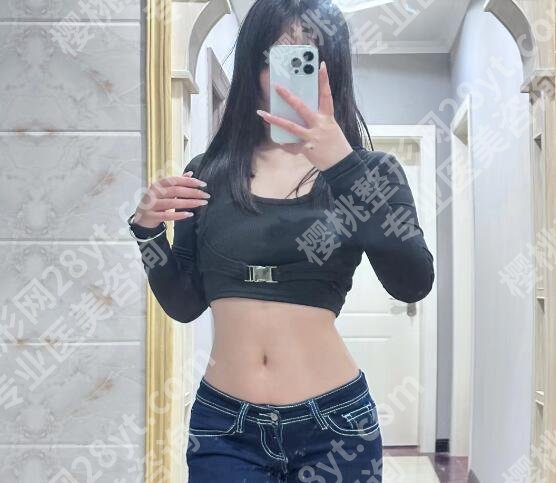 张心瑜医生的有效果吗？医生个人信息|吸脂案例图展示！