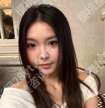 西安医学院第二附属医院整形美容外科怎么样？陈杰、栗娜都是人气医生