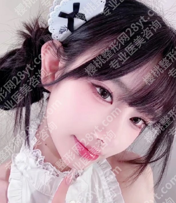 南京华韩奇致整形医院正规吗？医院介绍及真实案例分享