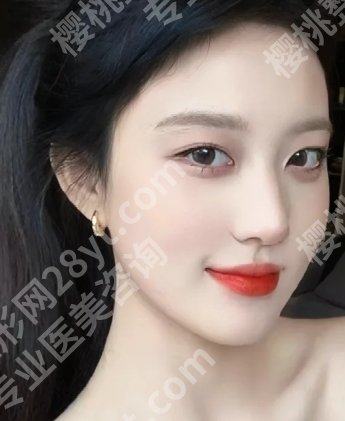 北京沃尔整形医院怎么样?团队、技术、口碑、收费、服务、案例多方面解析