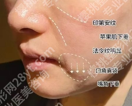 福州抗衰医美医生排名怎么样？top5实力医生盘点