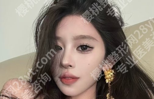 南方医院脂肪填充技术如何？内附真实案例分享！收藏速看！