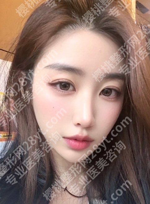 南京米兰柏羽裴旭芳做双眼皮吗？基本信息及真实网友体验反馈