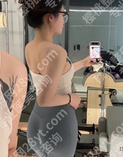北京嘉禾整形医院做富贵包手术超好!到院须知、交通路线、科室简介及面诊要点