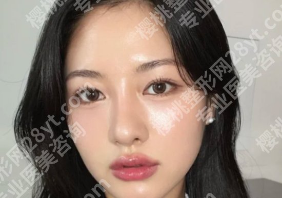 南京面部吸脂哪家比较好？美贝尔、康美、施尔美等医院榜上有名！