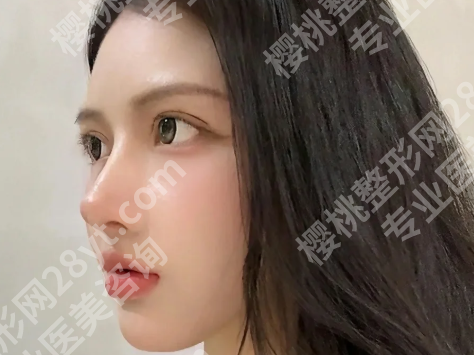 汪洪源医生案例怎么样？细看医生案例过程