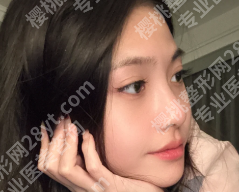 宋维铭医生拉皮案例怎么样？一起来看看面诊流程和案例详情