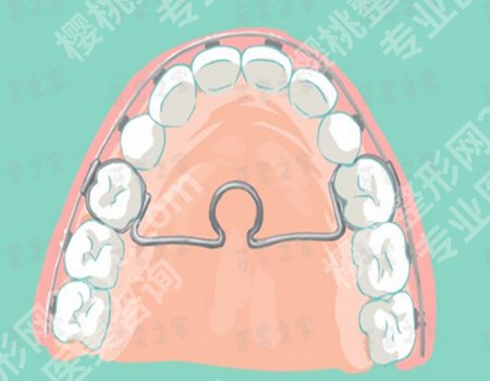正夫口腔杨瑞锋医生怎么样？一键了解面诊流程，相关攻略在线发布