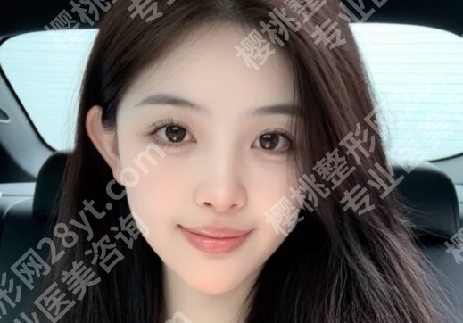 广州面吸哪个医生好？张立宪、张金明、杨璐等专家都榜上有名！就诊必看！
