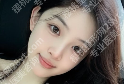 重庆面吸哪个医生技术好？2025全新价格表新鲜出炉！快进来看详细介绍！