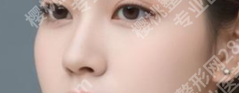 姜鑫利做鼻子怎么样？真人案例分享！来看价格表
