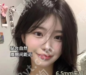 哈尔滨艺星做双眼皮怎么样？技术口碑点评以及医生选择小建议来袭！