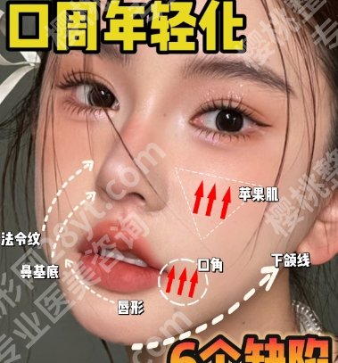 青岛面部脂肪填充医生哪位技术好？当地口碑医生分享