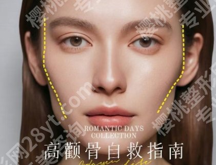 颧骨内推三甲医院多少钱？哪家医院好？2025收费表参考