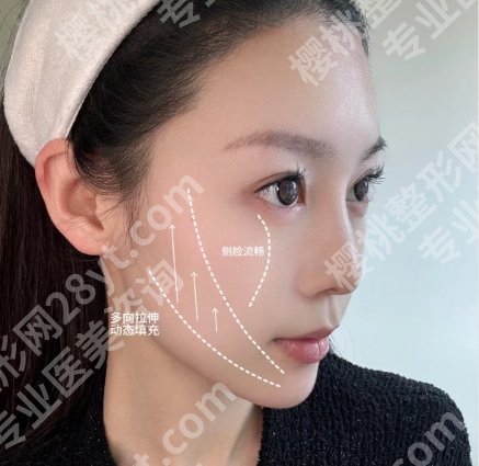 孙逸仙整形外科刘欢欢医生口碑怎么样？真人抗衰效果图展示！