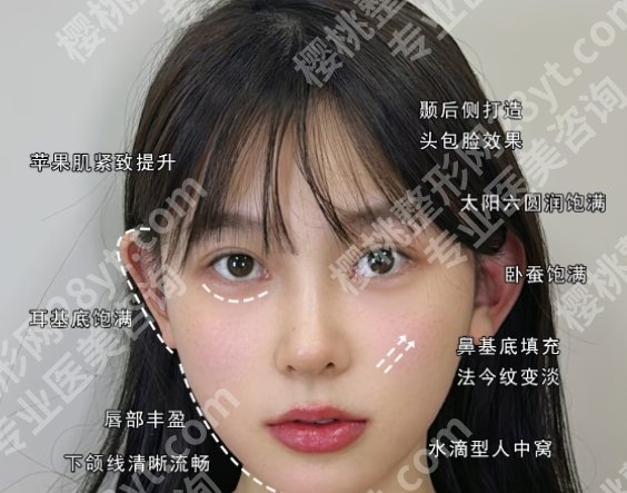 北京脂肪填充失败修复哪里好？各医院真实技术在线了解！