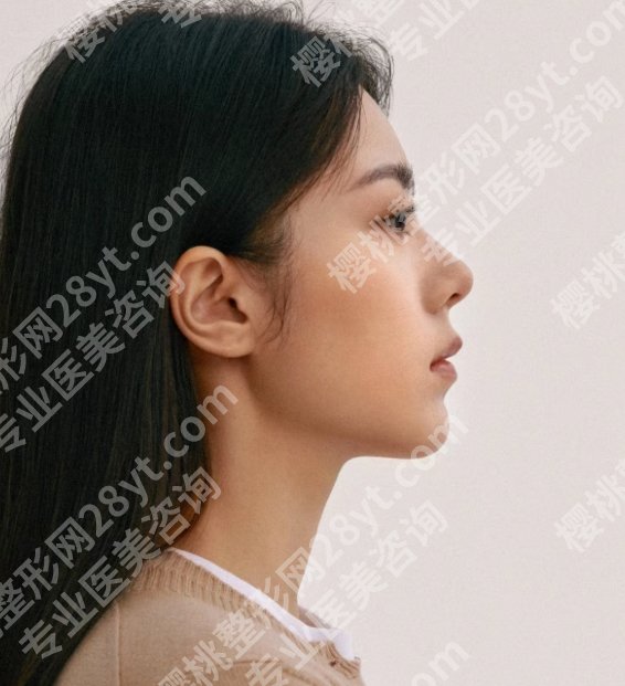 上海六院正颌手术费用贵不贵？2025收费标准出炉！点击收藏