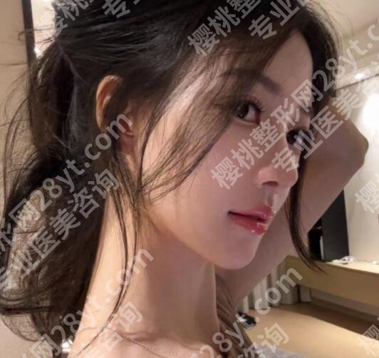 海淀医院隆鼻怎么样？医院简介|详细地址|案例图反馈！