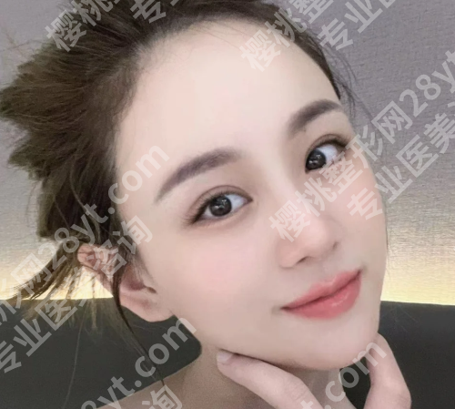 成都杨迪在哪个医院？揭晓坐诊医院和热门医生资料分享