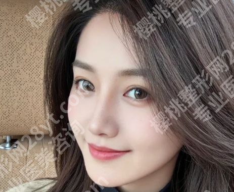 北京薛红宇拉皮做的好吗？含医生信息和案例过程速看