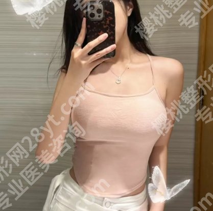 武汉协和医院隆胸价格是多少？假体隆胸费用15500元起