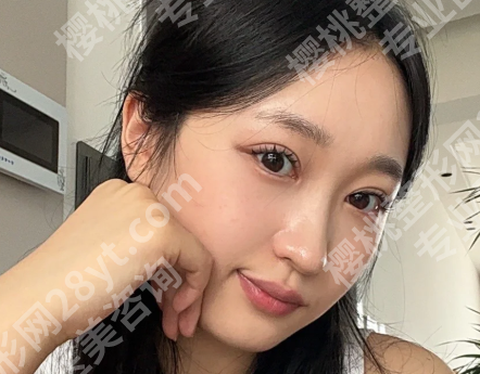 杭州杨海波鼻修复怎么样？公布医生资料，含面诊过程