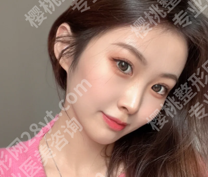 李方奇取生长因子怎么样？面诊过程在线了解啦