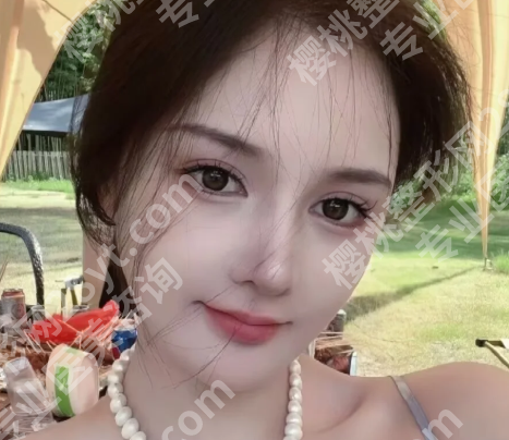 广州赵卉做双眼皮做了多久了？揭晓医生简介_面诊攻略了解